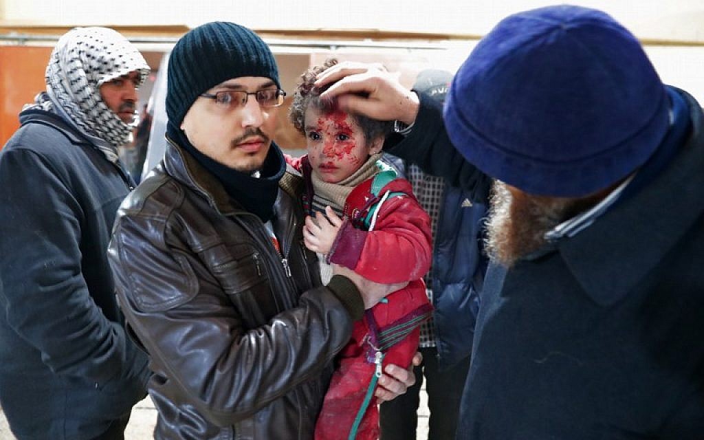 A wounded Syrian child is treated at a makeshift hospital in the rebel-held town of Douma, on the eastern outskirts of Damascus, following reported air strikes on December 29, 2016. (AFP PHOTO/Abd Doumany) A wounded Syrian child is treated at a makeshift hospital in the rebel-held town of Douma, on the eastern outskirts of Damascus, following reported air strikes on December 29, 2016. (AFP PHOTO/Abd Doumany)