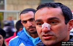 Eitan Rond speaking to reporters from Hadassah Ein Kerem hospital in Jerusalem on January 8, 2017. (screen capture: Channel 2)