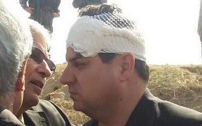 MK Ayman Odeh of the Joint List at the scene of a fatal incident in the Bedouin village of Umm al-Hiran, where he was injured, on Wednesday, January 18, 2017 (Dov Lieber/Times of Israel)