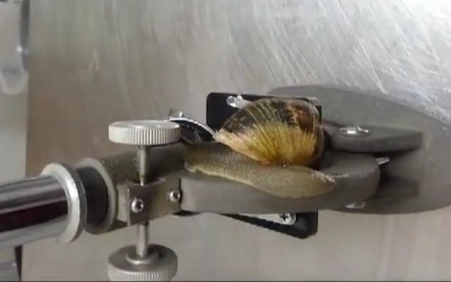 It's a snail's life at the Haclinica veterinary surgery in Tel Aviv, where vets have developed an expertise in shell repair. (YouTube screenshot) It's a snail's life at the Haclinica veterinary surgery in Tel Aviv, where vets have developed an expertise in shell repair. (YouTube screenshot)