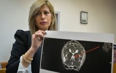 Shira Nir, a lawyer of an American-Israeli teenager suspected of calling in fake bomb threats to Jewish community centers across the world, shows the Rishon Lezion Magistrate's Court what she says is an image of a cancerous growth in her client's brain, on March 30, 2017.  (Flash90)