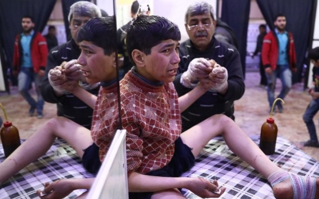 A wounded Syrian youth cries at a makeshift clinic following reported airstrikes by government forces in the rebel-held town of Douma, on the eastern outskirts of Damascus, on April 3, 2017. (Abd Doumany/AFP)