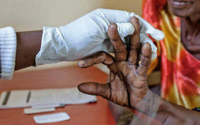 An elderly woman gets tested for malaria at FIMRC Health Center III in Bududa district, eastern Uganda, on April 7, 2017. (Esther MABABZI / AFP)