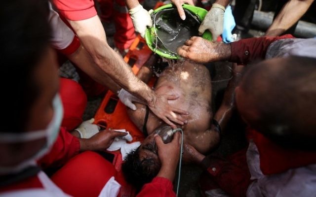 Rescue workers try to resuscitate a coal miner after he was pulled out from a mine in Azadshahr, in northern Iran, following an explosion leaving dozens of miners trapped on May 3, 2017. (AFP PHOTO / TASNIM NEWS / Mostafa HASSANZADEH) Rescue workers try to resuscitate a coal miner after he was pulled out from a mine in Azadshahr, in northern Iran, following an explosion leaving dozens of miners trapped on May 3, 2017. (AFP PHOTO / TASNIM NEWS / Mostafa HASSANZADEH)