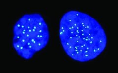 A haploid cell on the left, with 23 chromosomes; a diploid cell on the right, with 46 chromosomes (Courtesy)