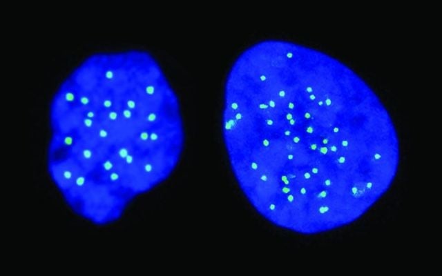 A haploid cell on the left, with 23 chromosomes; a diploid cell on the right, with 46 chromosomes (Courtesy) A haploid cell on the left, with 23 chromosomes; a diploid cell on the right, with 46 chromosomes (Courtesy)