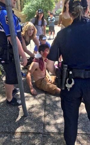 A person is treated by first responders after a deadly stabbing attack on University of Texas campus in Austin, Texas, Monday, May 1, 2017. (Emily Johnson via AP)
