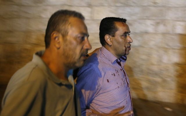 A Palestinian man, wounded during clashes with Israeli security forces, walks next to Lions' Gate in Jerusalem's Old City on July 18, 2017. (AFP/AHMAD GHARABLI)