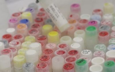 Research samples at the Hebrew University of Jerusalem. Researchers call the findings a 'canary in a coal mine' regarding overall health in Western countries. (YouTube screenshot)
