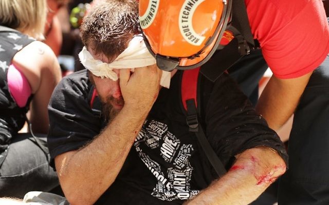 Rescue workers and medics tend to a man injured when a car plowed through a crowd of counter-demonstrators marching against white nationalists through the downtown shopping district August 12, 2017 in Charlottesville, Virginia. (Chip Somodevilla/Getty Images/AFP) Rescue workers and medics tend to a man injured when a car plowed through a crowd of counter-demonstrators marching against white nationalists through the downtown shopping district August 12, 2017 in Charlottesville, Virginia. (Chip Somodevilla/Getty Images/AFP)
