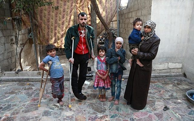 A Syrian man suffering from severe legs injuries following shelling in the rebel held areas around Damascus is surrounded by his children, one of them with only one leg, at their house in the Eastern Ghouta town of Hamouria, on October 23, 2017. (AFP Photo/Abdulmonam Eassa) A Syrian man suffering from severe legs injuries following shelling in the rebel held areas around Damascus is surrounded by his children, one of them with only one leg, at their house in the Eastern Ghouta town of Hamouria, on October 23, 2017. (AFP Photo/Abdulmonam Eassa)