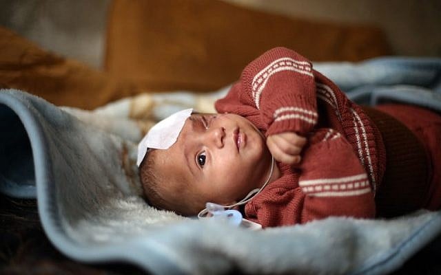 A picture taken on December 24, 2017, shows Syrian baby Karim Abdallah, who lost an eye as well as his mother in government shelling on Ghouta, being pictured inside his family home in the town of Beit Sawa in Syria's besieged eastern Ghouta region. (AFP PHOTO / Amer ALMOHIBANY) A picture taken on December 24, 2017, shows Syrian baby Karim Abdallah, who lost an eye as well as his mother in government shelling on Ghouta, being pictured inside his family home in the town of Beit Sawa in Syria's besieged eastern Ghouta region. (AFP PHOTO / Amer ALMOHIBANY)