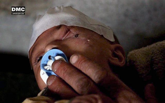 Karim, an infant from the besieged Eastern Ghouta suburb of Damascus, who was injured weeks ago in a government bombing of the market of his hometown. (Damascus Media Center via AP) Karim, an infant from the besieged Eastern Ghouta suburb of Damascus, who was injured weeks ago in a government bombing of the market of his hometown. (Damascus Media Center via AP)