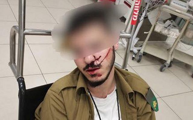 An IDF soldier who was beaten by two fellow members of his unit. (Facebook) An IDF soldier who was beaten by two fellow members of his unit. (Facebook)