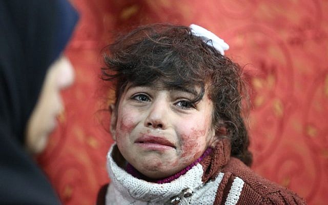 Hala, 9, receives treatment at a makeshift hospital following Syrian government bombardments on rebel-held town of Saqba, in the besieged Eastern Ghouta region on the outskirts of the capital Damascus on February 22, 2018. (AFP PHOTO / AMER ALMOHIBANY) Hala, 9, receives treatment at a makeshift hospital following Syrian government bombardments on rebel-held town of Saqba, in the besieged Eastern Ghouta region on the outskirts of the capital Damascus on February 22, 2018. (AFP PHOTO / AMER ALMOHIBANY)
