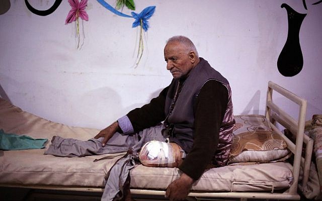 A Syrian man wounded in air strikes receives treatment at a makeshift hospital in the rebel-held enclave of eastern Ghouta, on February 25, 2018. (AFP PHOTO / AMER ALMOHIBANY)