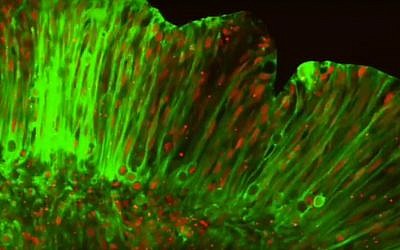 Screenshot from time-lapse images showing nuclear motion and cell division in a normal organoid where the brain develops folding. (Youtube screenshot/Weizmann Institute of Science)