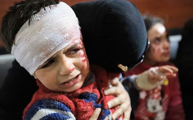 Wounded Syrians await treatment at a clinic in the rebel-held town of Hamouria, in the besieged Eastern Ghouta region on the outskirts of the capital Damascus on March 7, 2018, following reported government bombardments. (AFP PHOTO / Abdullah HAMMAM) Wounded Syrians await treatment at a clinic in the rebel-held town of Hamouria, in the besieged Eastern Ghouta region on the outskirts of the capital Damascus on March 7, 2018, following reported government bombardments. (AFP PHOTO / Abdullah HAMMAM)