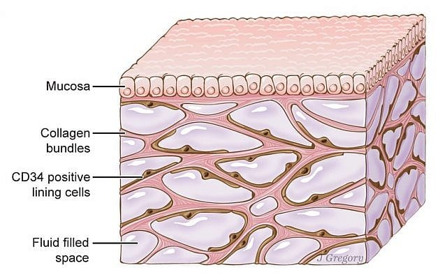 The interstitium, showing collagen bundles, mucosa, and fluid filled space (Wikimedia Commons, Jill Gregory / Mount Sinai - http://www.jillkgregory.com/) The interstitium, showing collagen bundles, mucosa, and fluid filled space (Wikimedia Commons, Jill Gregory / Mount Sinai - http://www.jillkgregory.com/)