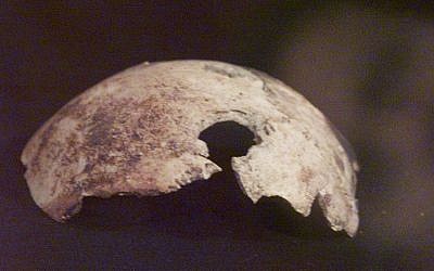 A skull fragment, that Russian officials claim came from Adolf Hitler's skull, is on dispay at an exhibition in Moscow, Wednesday, April 26, 2000.   (AP Photo/ Mikhail Metzel)