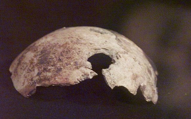 A skull fragment, that Russian officials claim came from Adolf Hitler's skull, is on dispay at an exhibition in Moscow, Wednesday, April 26, 2000. (AP Photo/ Mikhail Metzel) A skull fragment, that Russian officials claim came from Adolf Hitler's skull, is on dispay at an exhibition in Moscow, Wednesday, April 26, 2000. (AP Photo/ Mikhail Metzel)