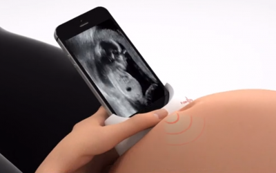 Computerized footage of an ultrasound device in development by Israeli startup PulseNmore. (Screen capture: Hadashot)