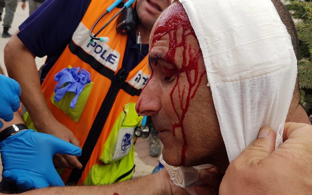 A police officer is treated by medics after being attacked by settlers during the evacuation of the illegal West Bank outpost of Netiv Ha'avot on June 12, 2018. (Israel Police)