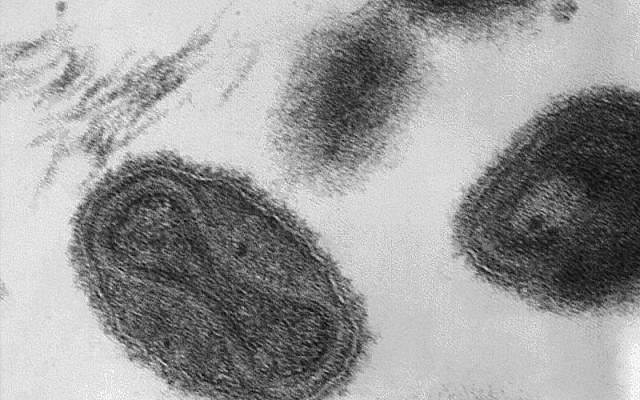 This transmission electron micrograph (TEM) depicts a number of smallpox virus virions (DC/ Dr. Fred Murphy; Sylvia Whitfield/Wikimedia Commons) This transmission electron micrograph (TEM) depicts a number of smallpox virus virions (DC/ Dr. Fred Murphy; Sylvia Whitfield/Wikimedia Commons)