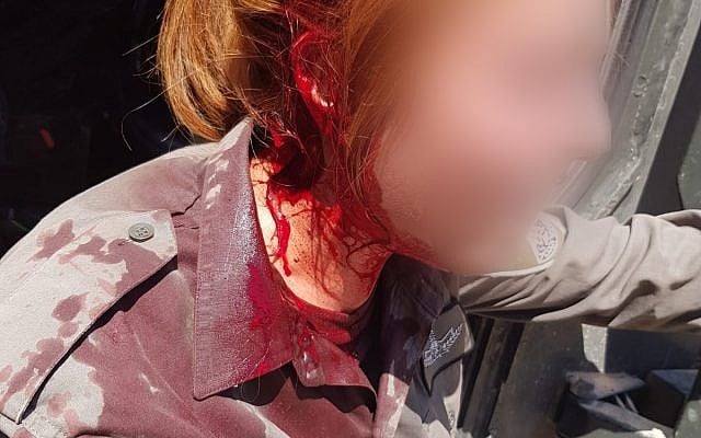 A Border Police officer after she was hit in the head by a stone thrown by Israeli settlers at an outpost adjacent to the northern West Bank settlement of Yitzhar on July 17, 2018. (Israel Police)