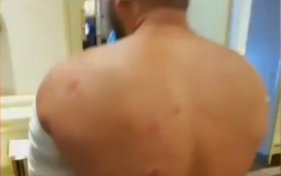 An Israeli beaten by Romanian police in Bucharest on August 10, 2018. (Screenshot: Twitter)