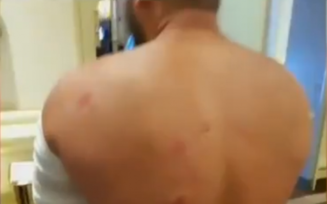 An Israeli beaten by Romanian police in Bucharest on August 10, 2018. (Screenshot: Twitter) An Israeli beaten by Romanian police in Bucharest on August 10, 2018. (Screenshot: Twitter)