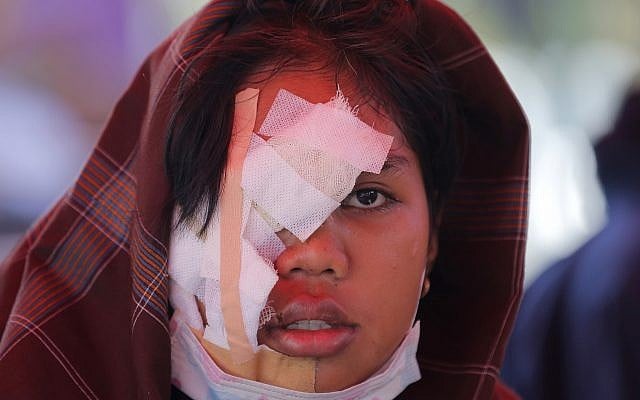 An earthquake victim is bandaged at a makeshift hospital in Palu, Central Sulawesi Indonesia, October 3, 2018. (Tatan Syuflana/AP) An earthquake victim is bandaged at a makeshift hospital in Palu, Central Sulawesi Indonesia, October 3, 2018. (Tatan Syuflana/AP)