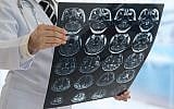 Illustrative image of a brain scan (utah778; iStock by Getty Images)