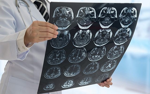 Illustrative image of a brain scan (utah778; iStock by Getty Images)