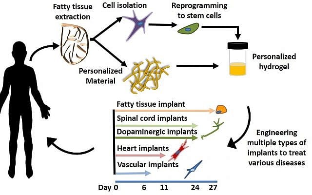 A small piece of a fat biopsy from a patient is engineered to become any type of tissue implant for regenerating defective organs, including the heart, spinal cord and brain, with minimal risk for rejection (Prof. Tal Dvir's lab; Tel Aviv University) A small piece of a fat biopsy from a patient is engineered to become any type of tissue implant for regenerating defective organs, including the heart, spinal cord and brain, with minimal risk for rejection (Prof. Tal Dvir's lab; Tel Aviv University)