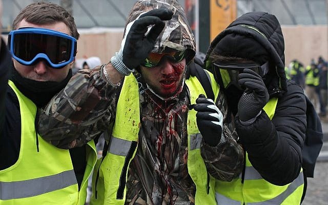 A demonstrator wearing a yellow vest is covered in blood after getting in injured during a protest in Paris, Dec. 8, 2018 (AP Photo/Thibault Camus)