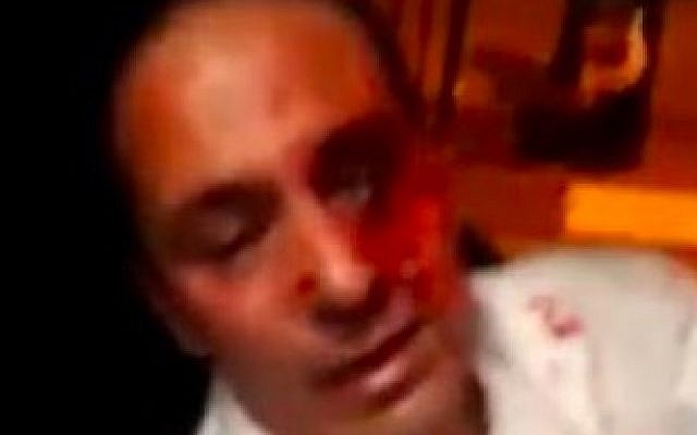 Palestinian bus driver brutally assaulted by Israeli passengers at Modiin Illit settlement on December 13, 2018. (Courtesy) Palestinian bus driver brutally assaulted by Israeli passengers at Modiin Illit settlement on December 13, 2018. (Courtesy)