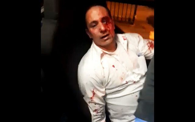 A Palestinian bus driver, who was brutally assaulted by Israeli passengers at the Modiin Illit settlement, on December 13, 2018. (Twitter screenshot) A Palestinian bus driver, who was brutally assaulted by Israeli passengers at the Modiin Illit settlement, on December 13, 2018. (Twitter screenshot)