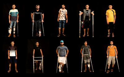 In this combination of 10 photos taken on September 19, 2018, Palestinians shot in the legs during demonstrations and riots at the Gaza strip's border with Israel await treatment at a Gaza City clinic run by MSF (Doctors Without Borders). (AP Photo/Felipe Dana)