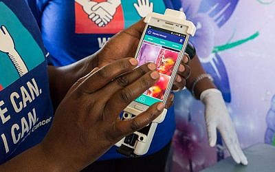 Israeli startup MobileODT has created the Eva System, which uses an Automated Visual Evaluation (AVE) algorithm that it says can detect cervical cancer by simply examining an image of the cervix (Courtesy)