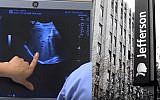 Illustrative image of the services at the medical center of the Thomas Jefferson University (TJU)(YouTube screenshot)