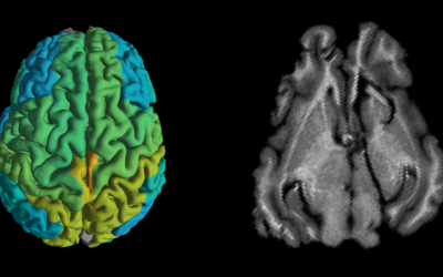 Standard MRI brain scan of a pig, right, and a new MRI scan showing differences in molecular makeup in different parts of the brain (Shir Filo/Hebrew University)