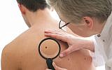Illustrative image of a dematologist checking a mole on a patient for signs of melanoma (AlexRaths; iStock by Getty Images)