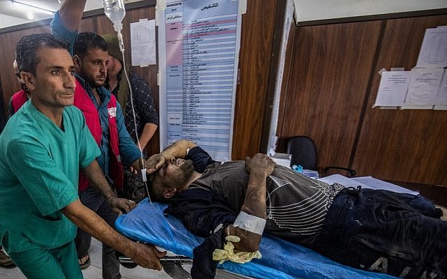 A man who was injured during the ongoing Turkish offensive against Kurdish-controlled areas of northeastern Syria lies at a hospital in Tal Tamr, near the Syrian Kurdish town of Ras al-Ain, October 18, 2019. (Delil Souleiman/AFP) A man who was injured during the ongoing Turkish offensive against Kurdish-controlled areas of northeastern Syria lies at a hospital in Tal Tamr, near the Syrian Kurdish town of Ras al-Ain, October 18, 2019. (Delil Souleiman/AFP)