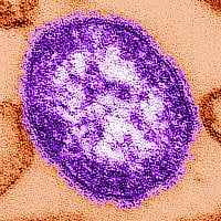 The measles virus. (Cynthia Goldsmith, the Centers for Disease Control and Prevention via AP)