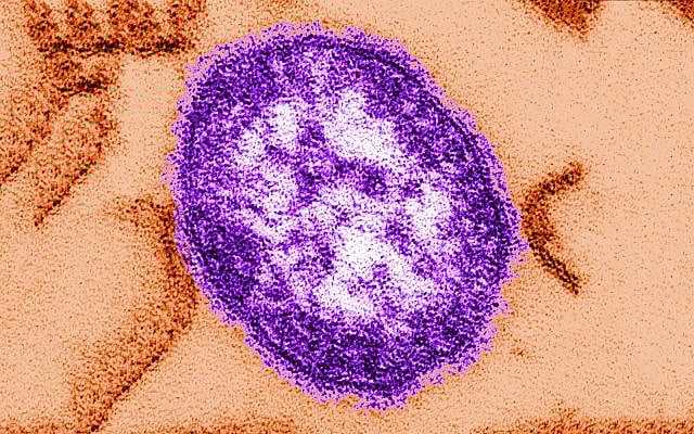 The measles virus. (Cynthia Goldsmith, the Centers for Disease Control and Prevention via AP)