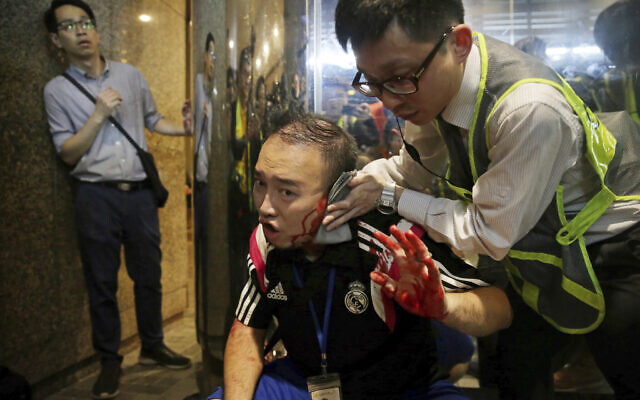 District councilor Andrew Chiu receives medical treatment in Hong Kong, on Nov. 3, 2019 (Elson Li/HK01 via AP) District councilor Andrew Chiu receives medical treatment in Hong Kong, on Nov. 3, 2019 (Elson Li/HK01 via AP)