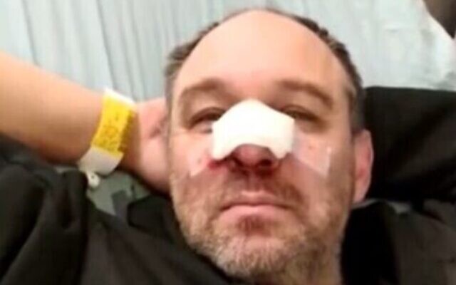 Screen capture from video of Dr. Michael Morris-Reich after he was allegedly assaulted by supporters of Prime Minister Benjamin Netanyahu in Jerusalem, December 7, 2019. (Channel 12) Screen capture from video of Dr. Michael Morris-Reich after he was allegedly assaulted by supporters of Prime Minister Benjamin Netanyahu in Jerusalem, December 7, 2019. (Channel 12)