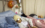 Nine-year-old Palestinian boy Malik Eissa in Hadassa hospital in Jerusalem, February 20, 2020 (AP Photo/Mahmoud Illean)