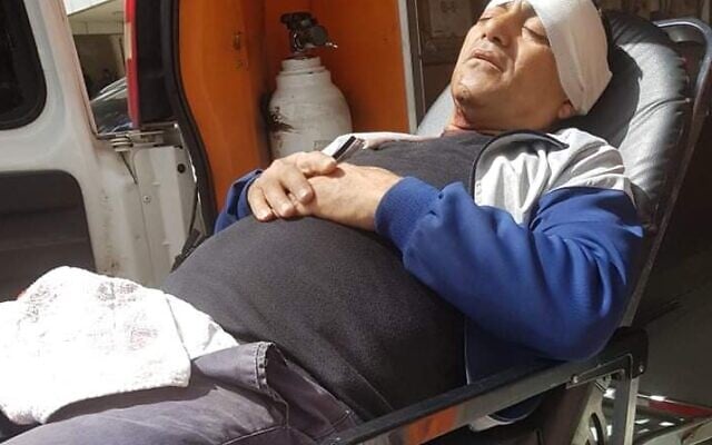 A pair of Palestinian farmer from Umm-Safa allegedly assaulted by Israeli farmers on March 24, 2020. (Yesh Din) A pair of Palestinian farmer from Umm-Safa allegedly assaulted by Israeli farmers on March 24, 2020. (Yesh Din)